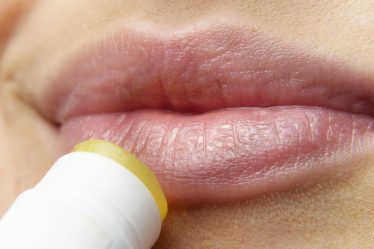 herpes site - lips