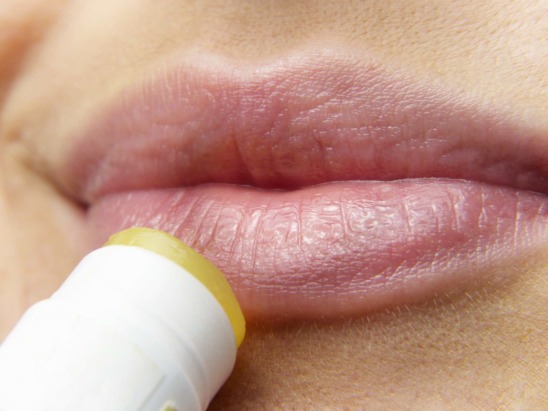 herpes site - lips